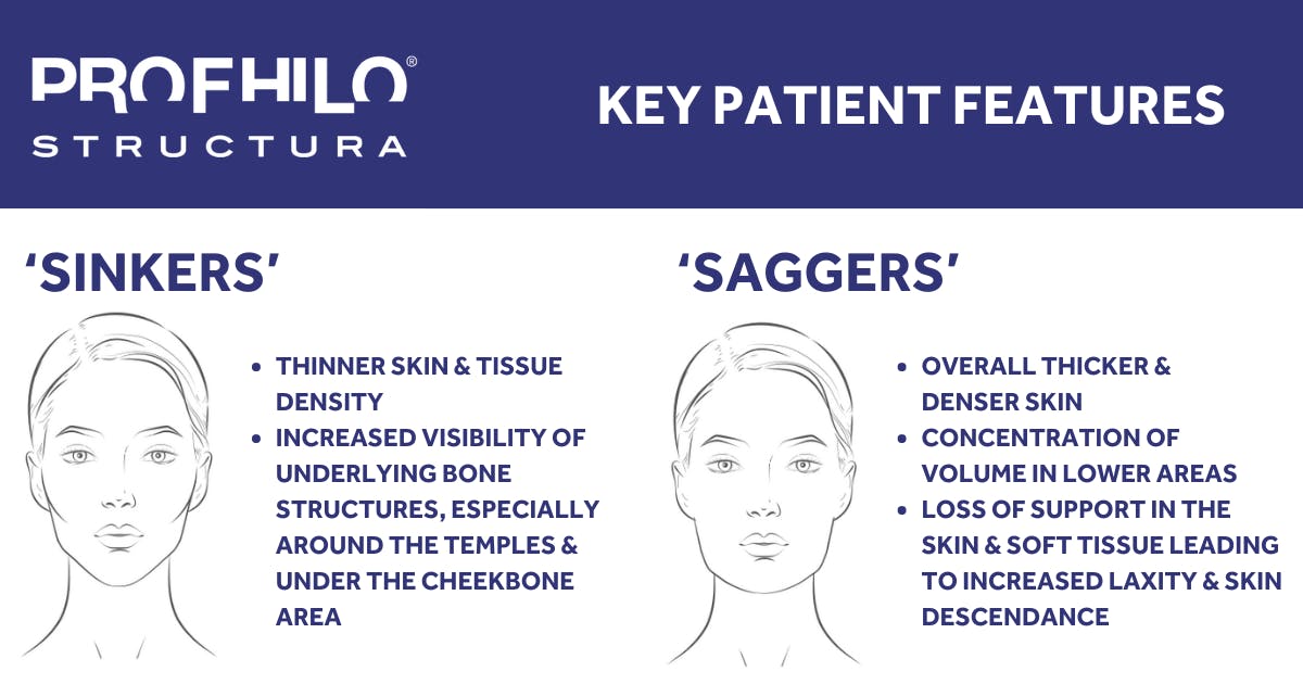 Slika: PROFHILO Structura lica - “sinkers” tip lica